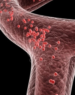 红色通道封面图